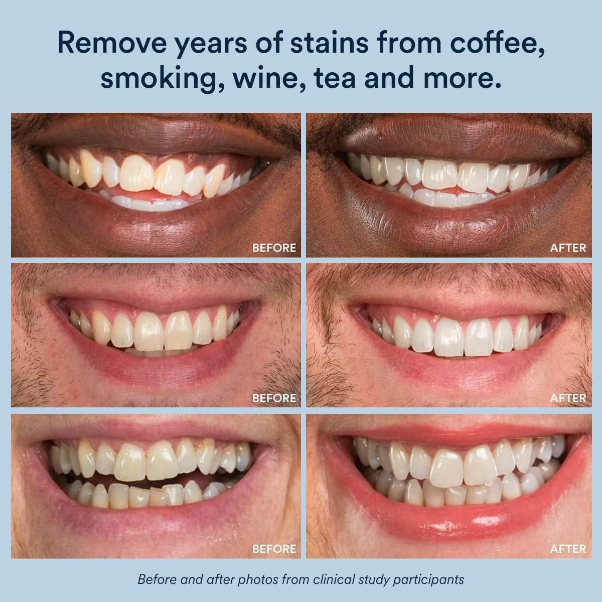 Auraglow PowerWhite Teeth Whitening Pen 4mL