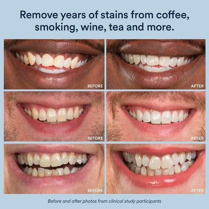 Auraglow PowerWhite Teeth Whitening Pen 4mL